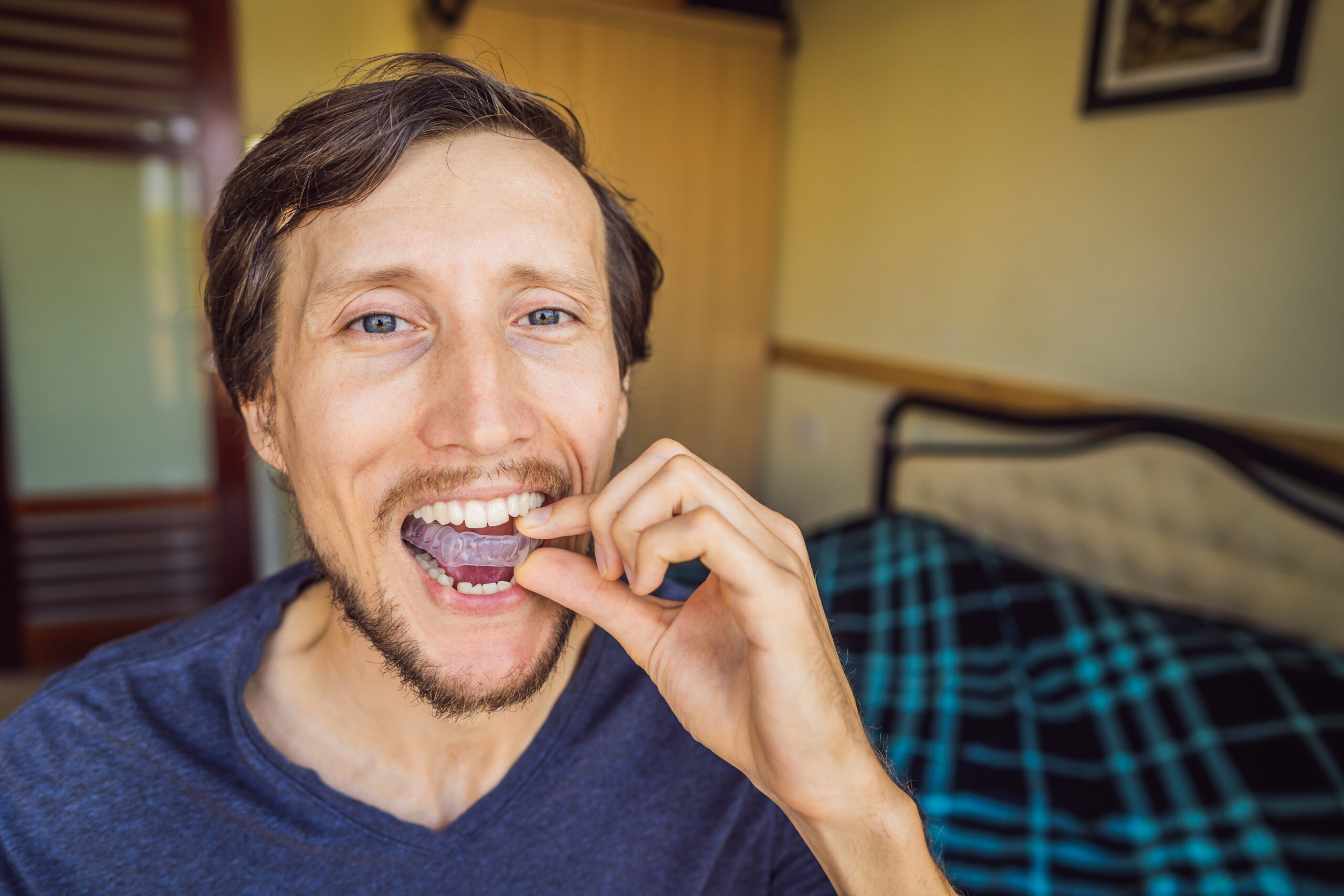 Man placing a bite plate in his mouth to protect his teeth at night from grinding caused by bruxism, close up view of his hand and the appliance